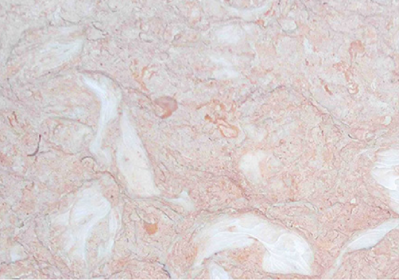 Đá Marble Hồng Sò